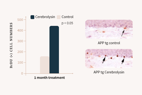 Neurogenesis